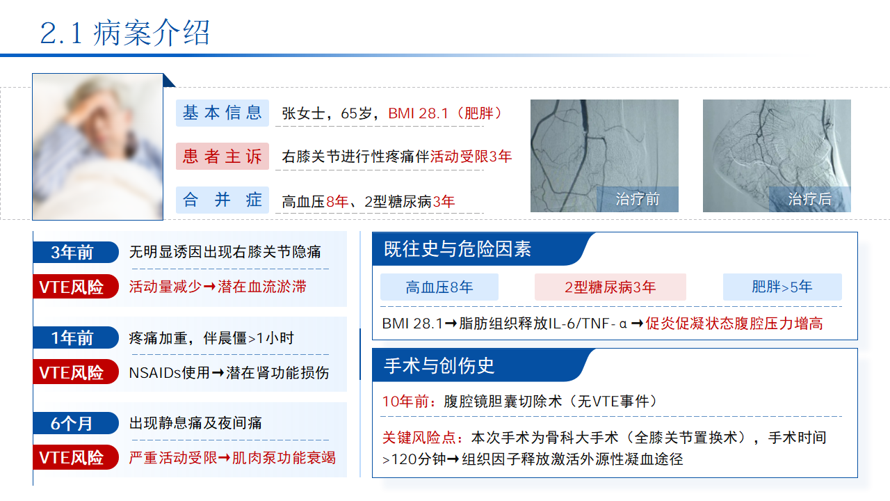 护理个案｜骨科手术后的静脉血栓预防 预览