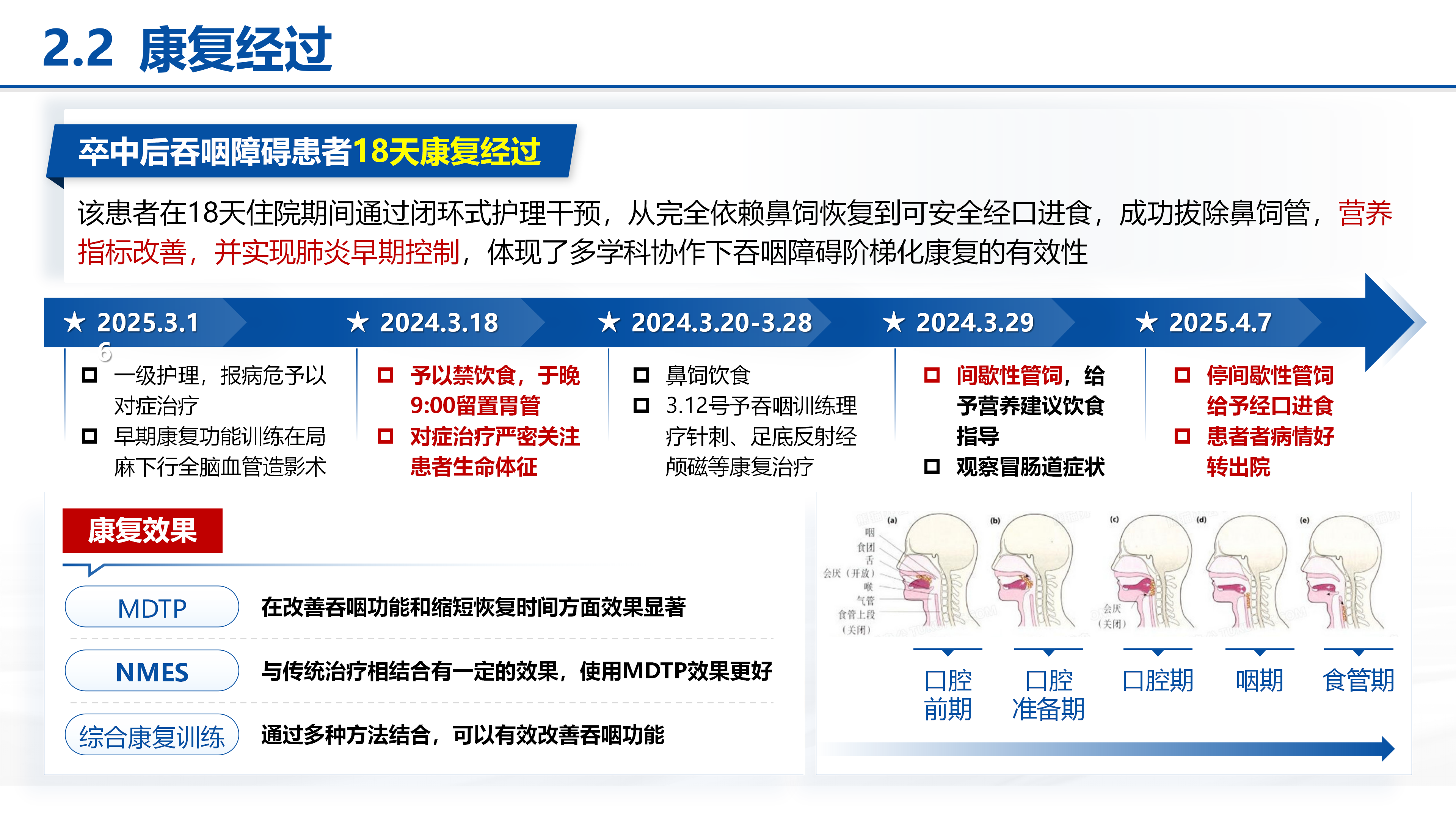 护理个案｜脑卒中后吞咽障碍患者的护理干预 预览